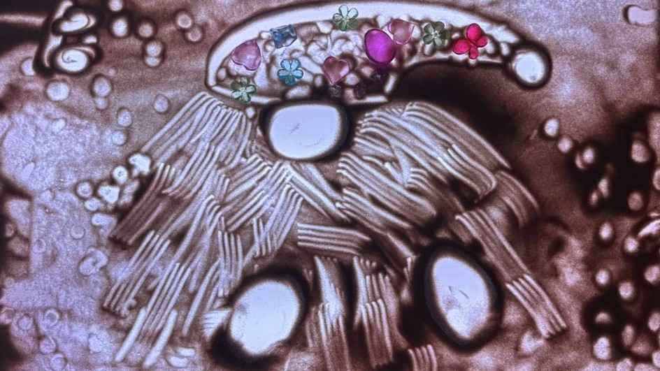 «Зимний гномик»